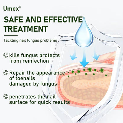 Toenail Fungus Treatment Extra Strength, Antifungal Solution for Toenail or Fingernail, Triple Action Formula for Remove Fungal, Repair and Renewal Damaged Nails 1.0 Fl Oz-KY