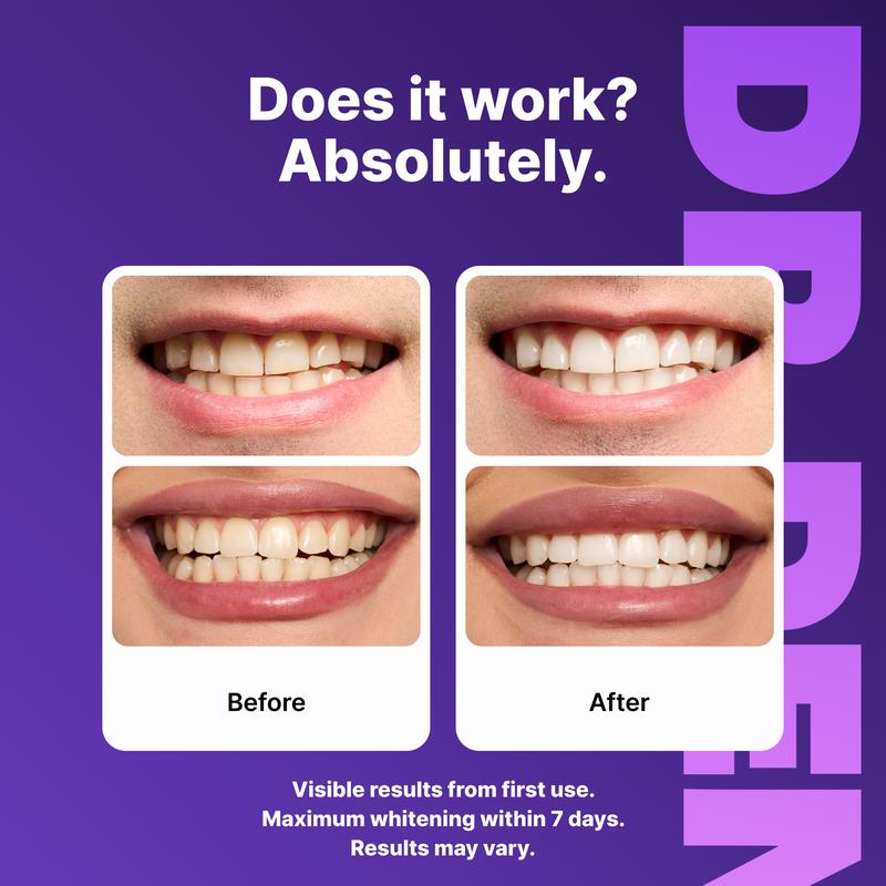 Purple Whitening Strips-KY