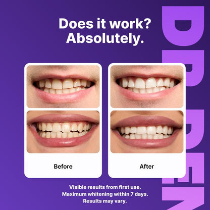 Purple Whitening Strips-KY