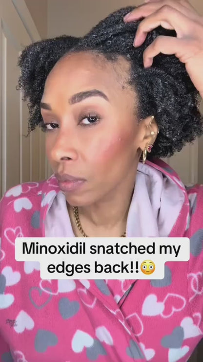 Be Bodywise Hair Growth Roll-On Serum-KY